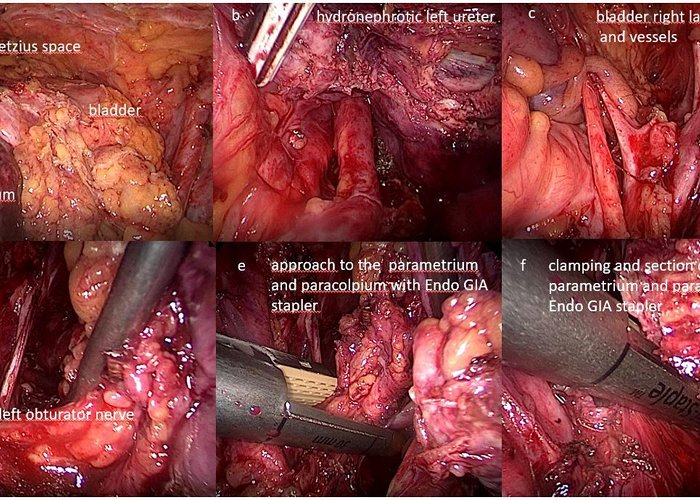 Giuseppe Brotzu Hospital Frontiers | Survival as a clinical outcome and its spiritual ... photo